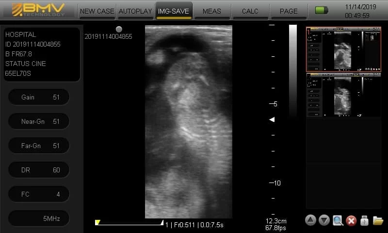 BESTSCAN ® S6 Touch Curve Bmv - Ultrasonido Veterinario - Imagen 15