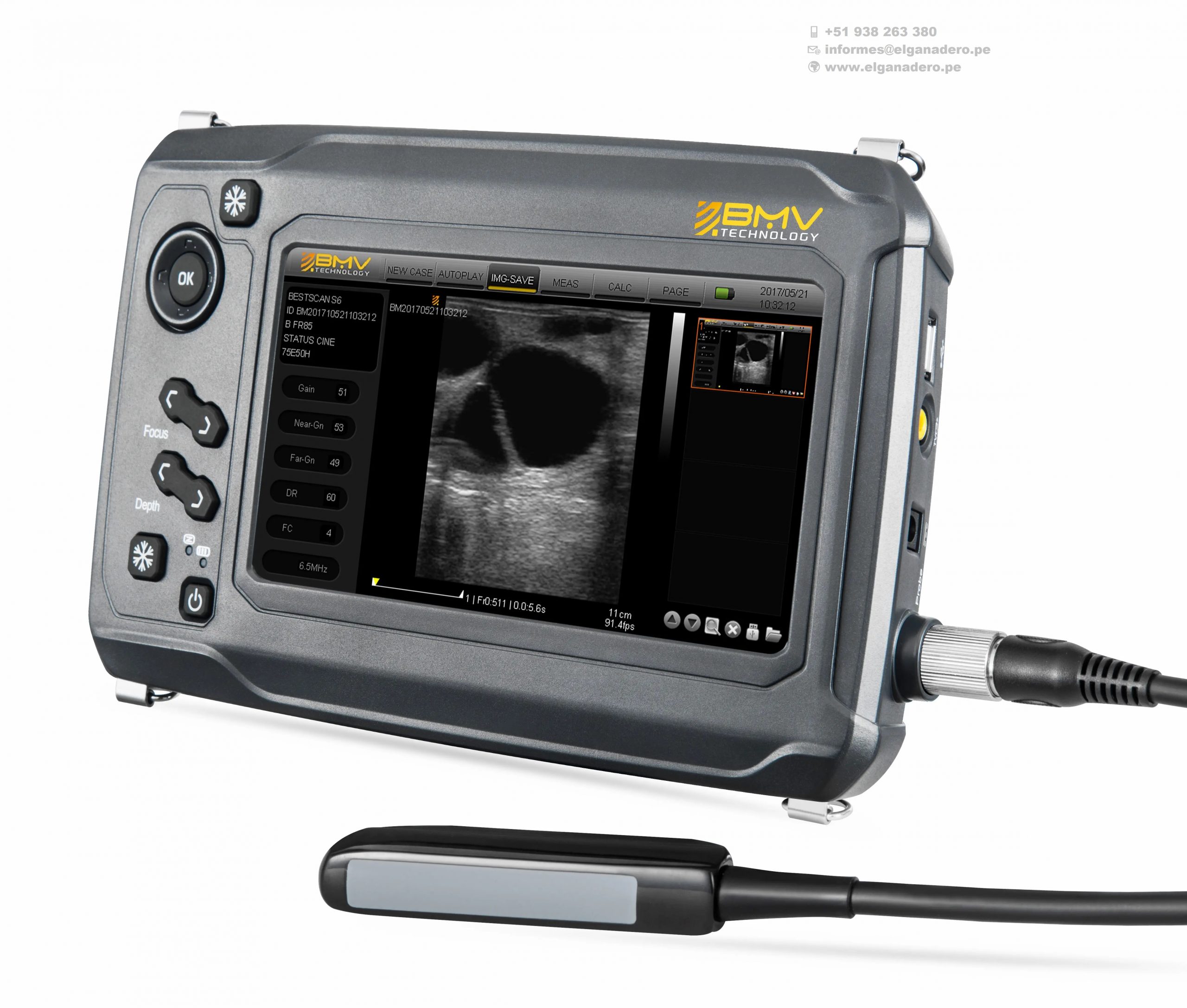 BESTSCAN ® S6 Touch Curve Bmv - Ultrasonido Veterinario - Imagen 19