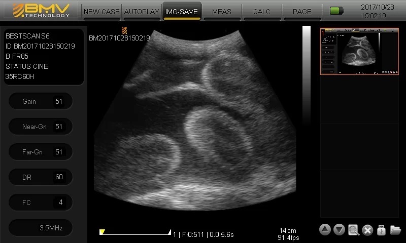 BESTSCAN ® S6 Touch Curve Bmv - Ultrasonido Veterinario - Imagen 7