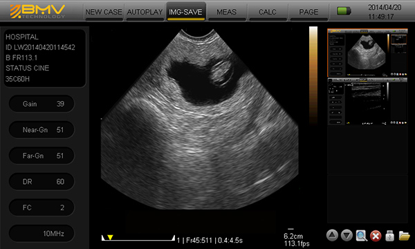 BESTSCAN ® S6 Touch Curve Bmv - Ultrasonido Veterinario - Imagen 12