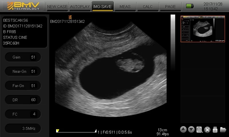 BESTSCAN ® S6 Touch Curve Bmv - Ultrasonido Veterinario - Imagen 16