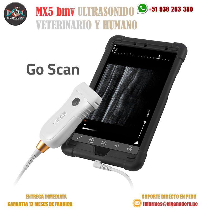 MX5 GO Ultrasonido - Imagen 2