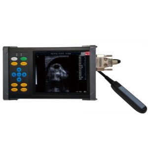 Ultrasonido Digital A20