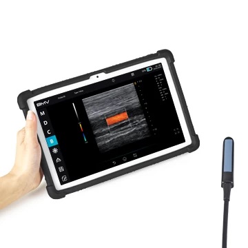 Ultrasonido BestScan S5 Plus - Imagen 3