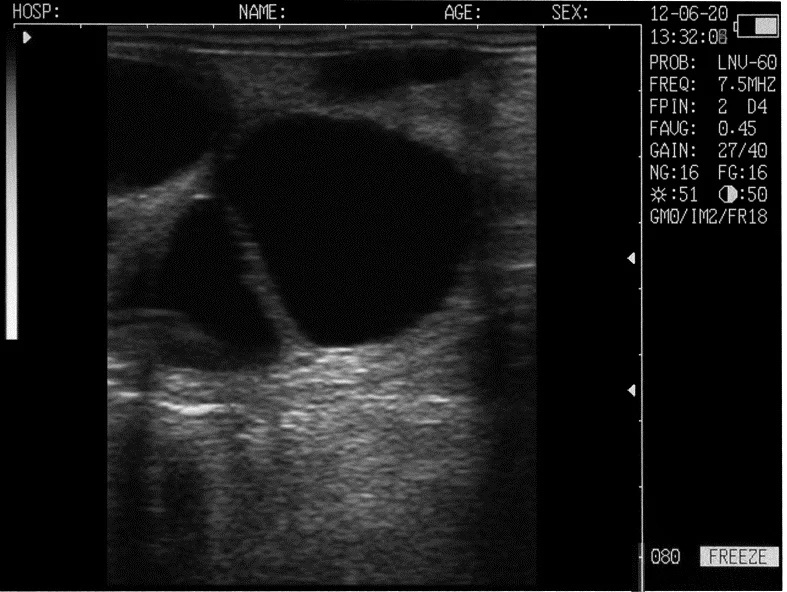 Ecógrafo L60 Ultra Compacto - Imagen 7
