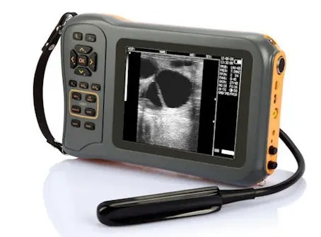 Ecógrafo L60 Ultra Compacto - Imagen 2